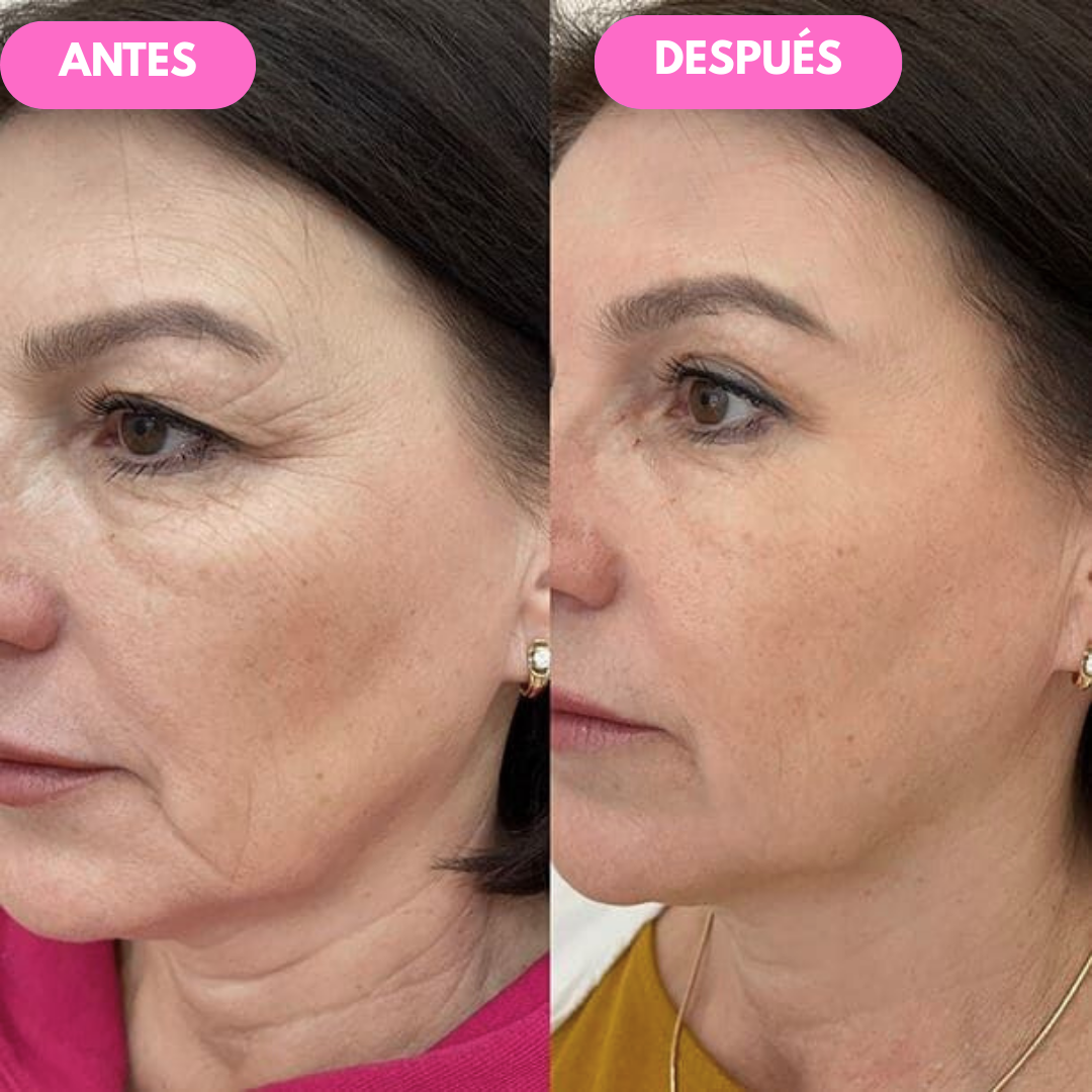 Pack AntiEdad | Crema Reafirmante para Ojos NIDA™ + Crema Reafirmante para Cuello y Escote NeckLuxe™
