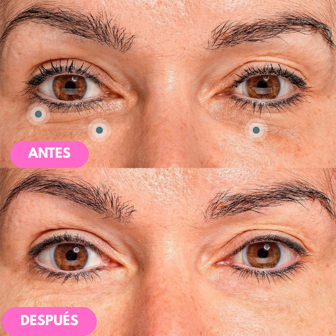 Pack AntiEdad | Crema Reafirmante para Ojos NIDA™ + Crema Reafirmante para Cuello y Escote NeckLuxe™