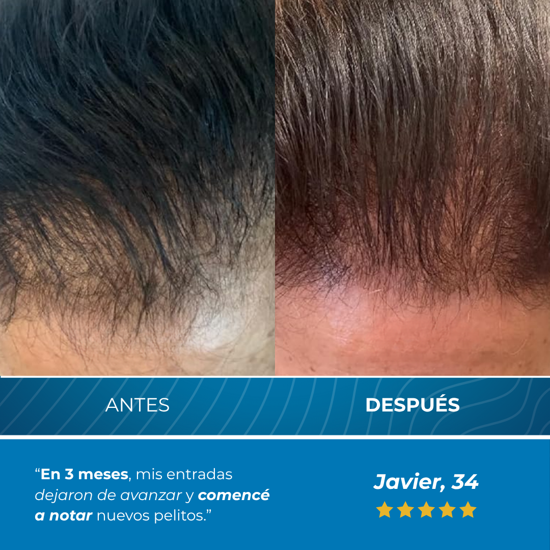 Sanorys BodyWise™ - Sérum Roll-On para la defensa contra tus entradas