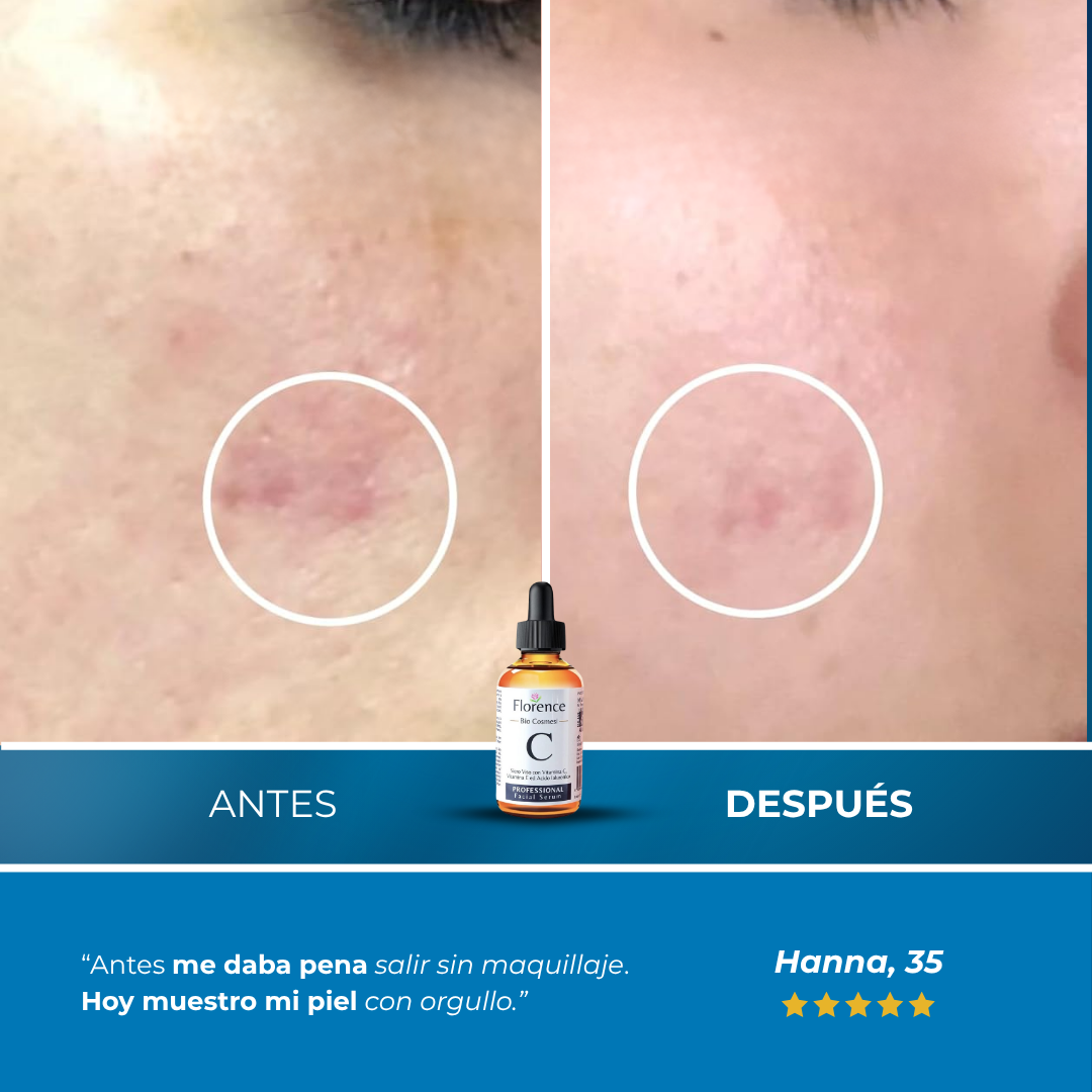 Sanorys Spot™ - BioSérum Eliminador de Manchas con Vitamina C