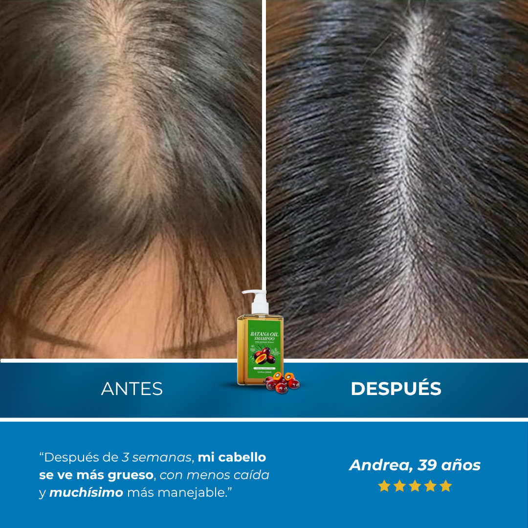 Sanorys Botana - Champú de Crecimiento Capilar con Aceite de Botana