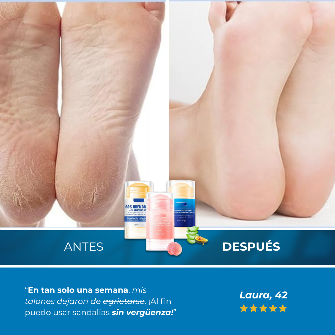 Sanorys Eoursha - Presume de pies perfectos al momento
