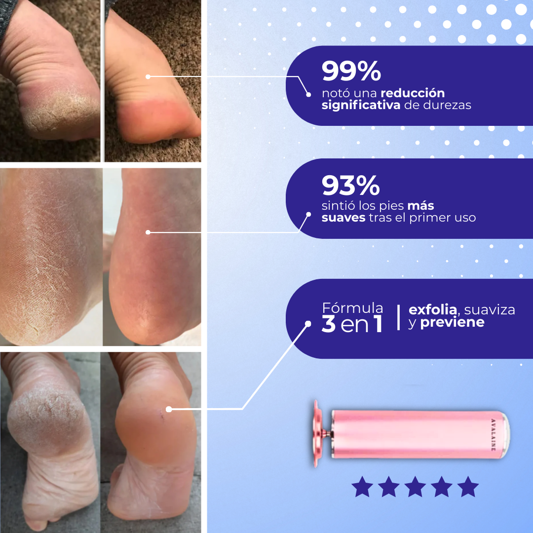 FootZen™ - Suaviza la piel y reduce tus callos desde el primer día