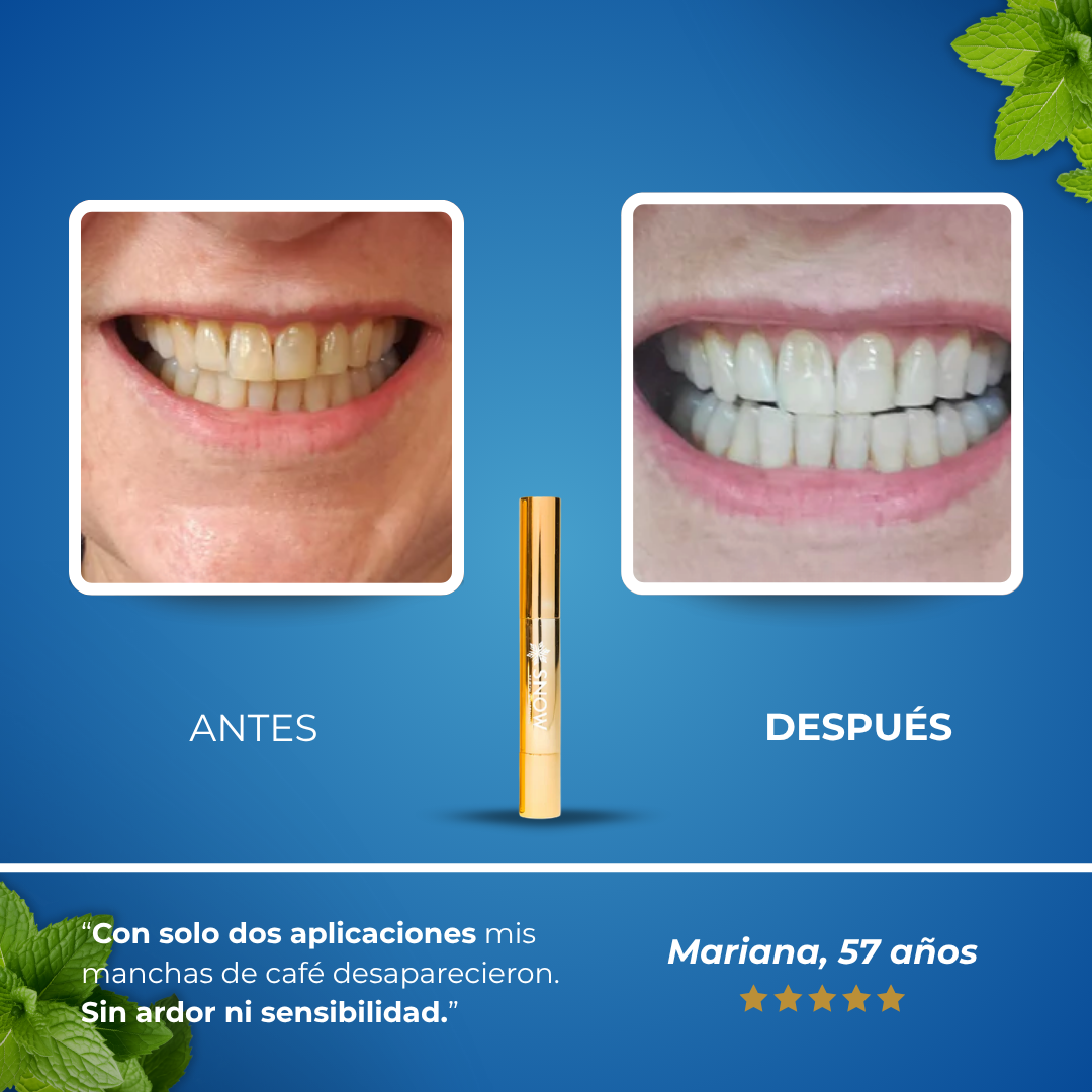 Sanorys™ - Lápiz con Suero blanqueador dental extrafuerte