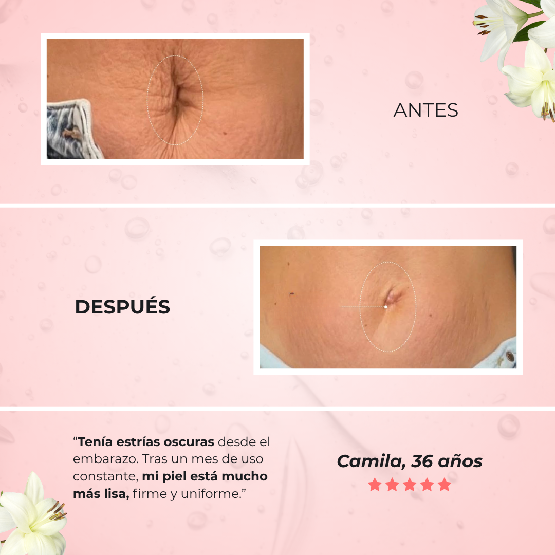 Sanorys B-Flat | Crema Reafirmante para un vientre más plano
