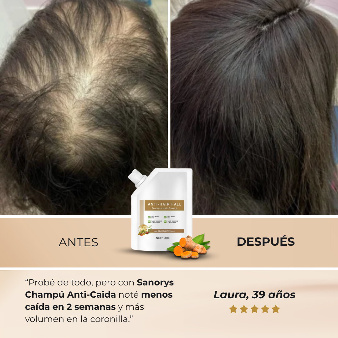 Champú Anti-Caida Sanorys - Frena tu Pérdida de Cabello en 7 días