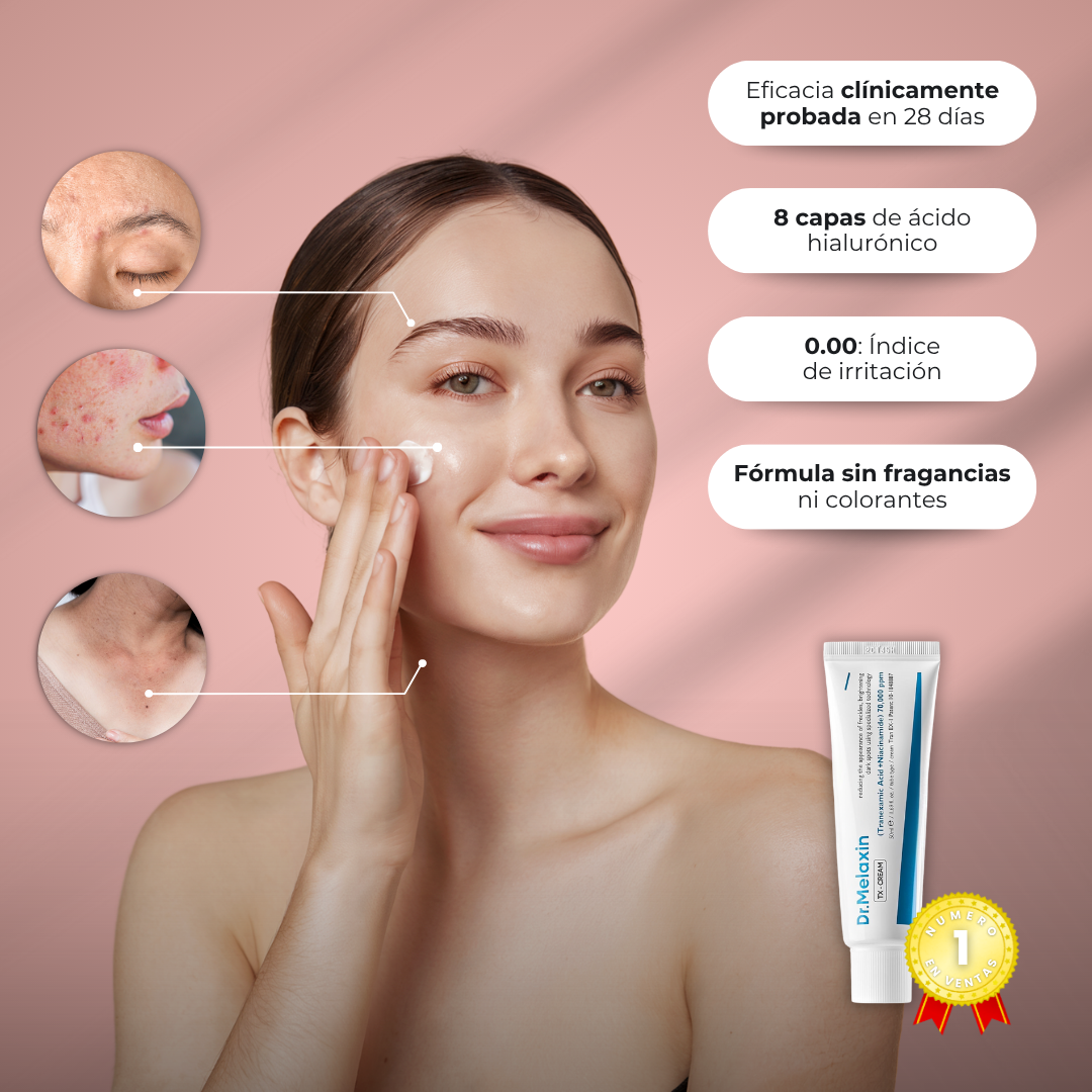 Sanorys Acid™ - Crema facial coreana eliminadora de manchas