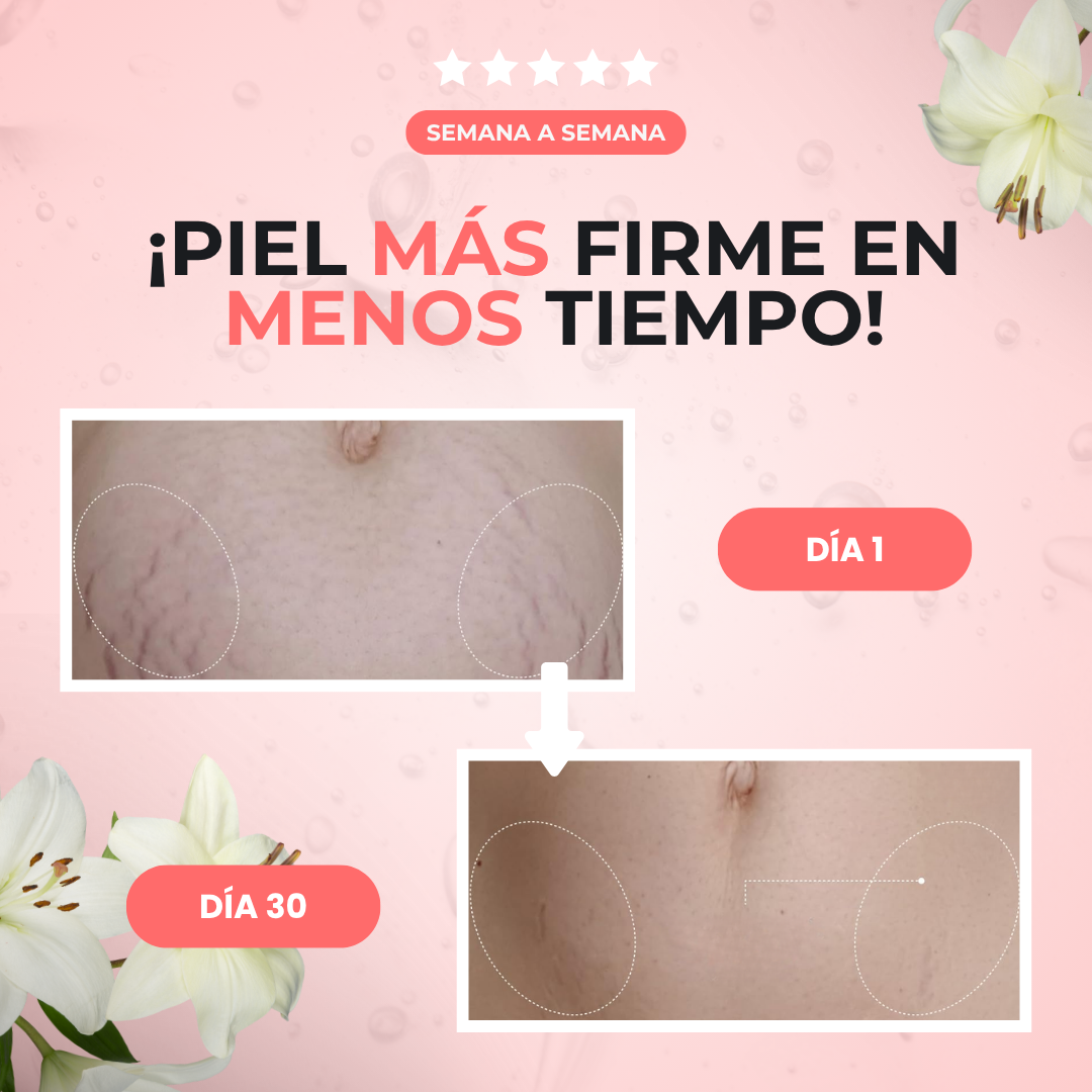Sanorys B-Flat | Crema Reafirmante para un vientre más plano