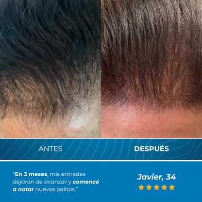 Sanorys BodyWise™ - Sérum Roll-On para la defensa contra tus entradas