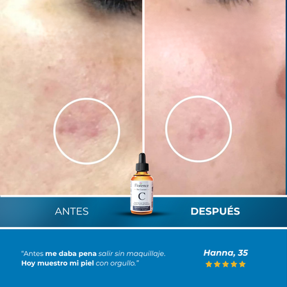 Sanorys Spot™ - BioSérum Eliminador de Manchas con Vitamina C