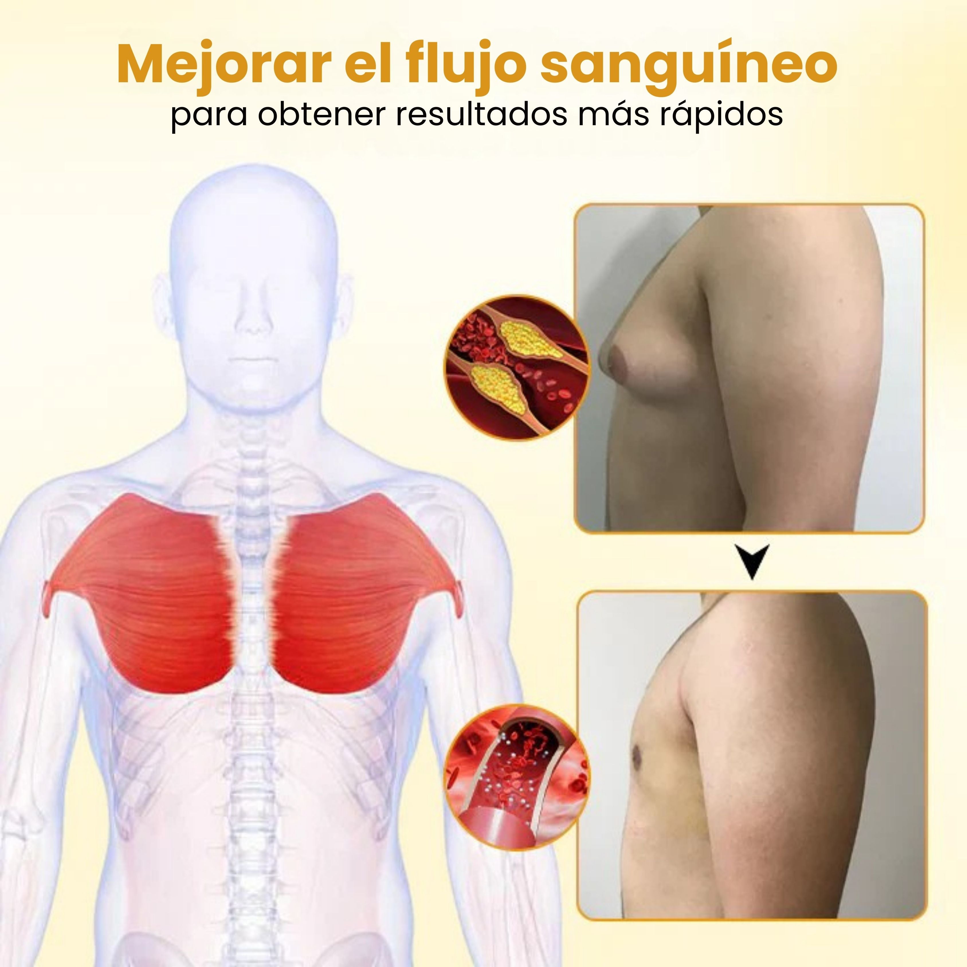 Sanorys ThermoFin™ - Elimina tu ginecomastia en 7 días | 1+1 GRATIS