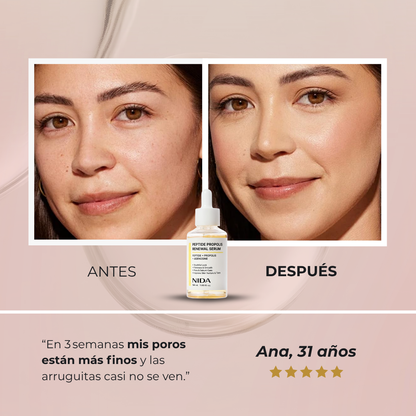 Sérum NIDA™ - Fórmula coreana con péptidos de abeja para eliminar poros por completo