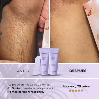 Sanorys Hair Removal - Crema para eliminar vello al instante
