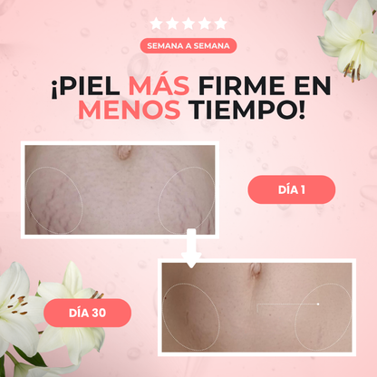 Sanorys B-Flat | Crema Reafirmante para un vientre más plano