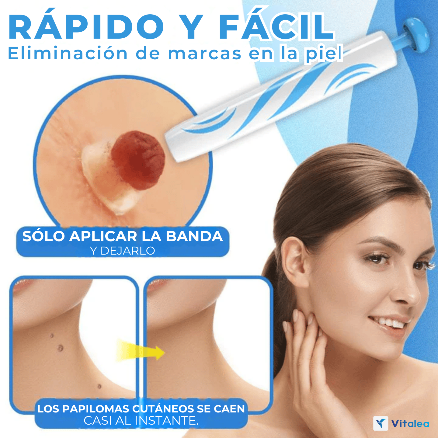 1+1 GRATIS| Vitalea PerfectFace™- Kit de eliminación de verrugas natural